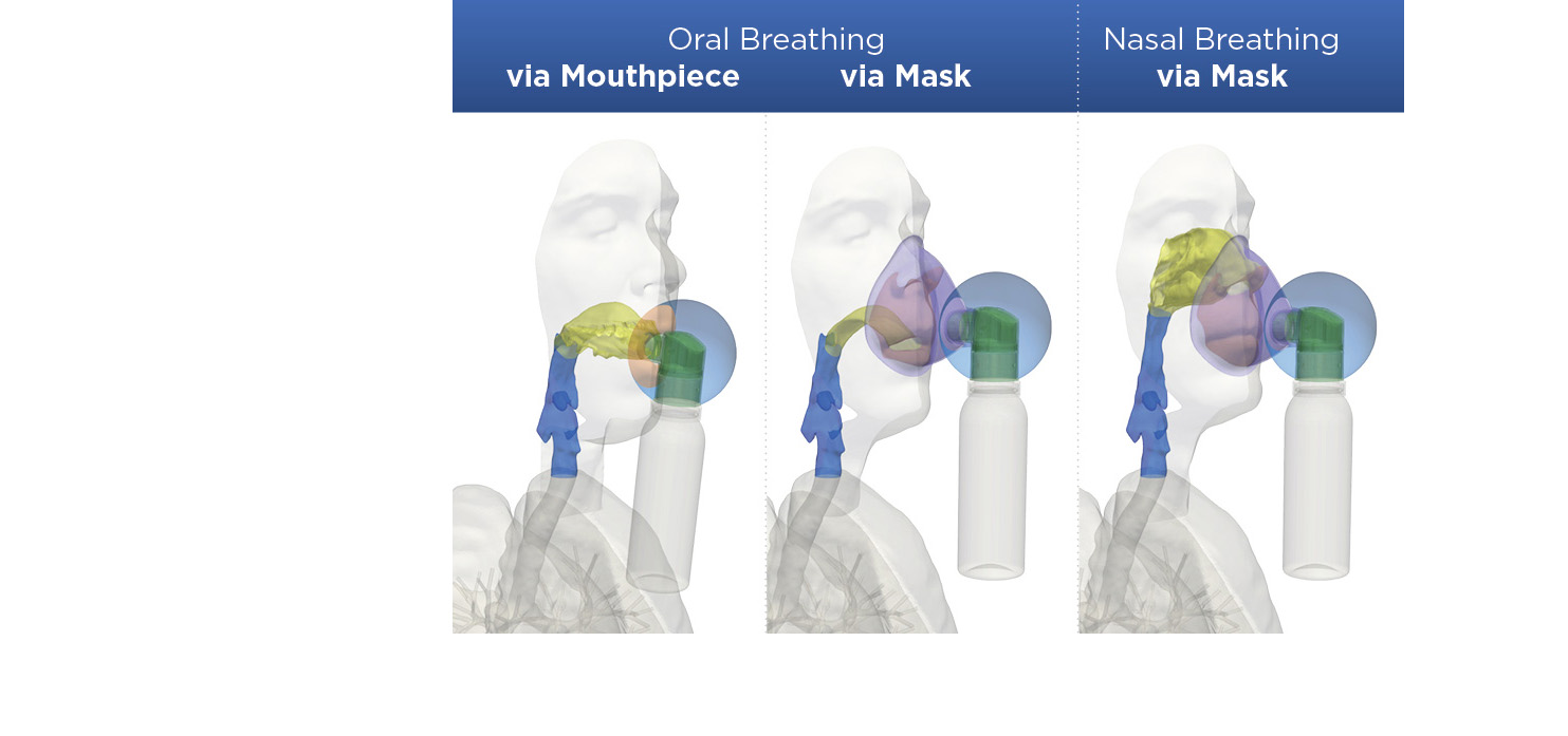 Three panel graphic of person's upper airways and deposition pattern of fine mist from configurations of PureHale dispenser.
